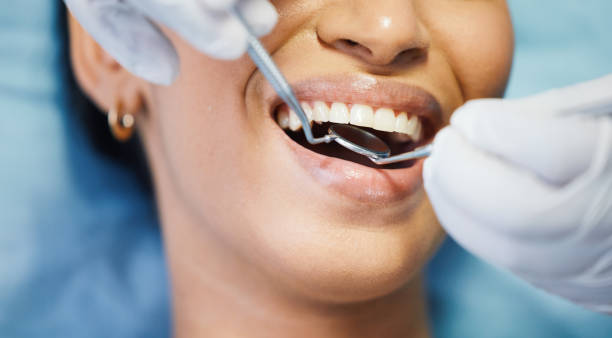 Best Emergency Treatment for Dental Infections or Abscesses in Olympia, SC